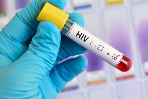 Primer caso de remisión de VIH en una mujer con trasplante de células madre
