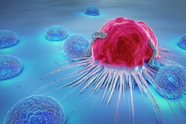 Un medicamento para bajar el colesterol también puede usarse para inhibir la metástasis del cáncer