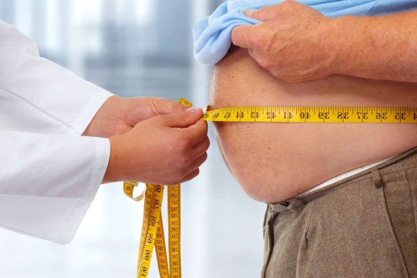 Los 10 motivos que explican el desarrollo de la obesidad y cómo tratarla