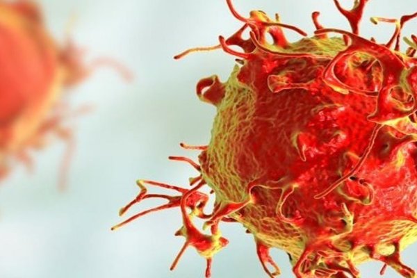 En 30 años el diagnóstico de la leucemia más frecuente en hombres aumentó el 35%