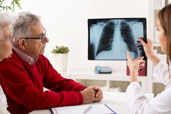 Aprobaron en el país una nueva droga para un subtipo de cáncer de pulmón