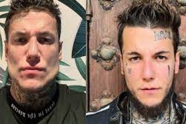 Alex Caniggia mostró su rostro tras someterse a un retoque en la mandíbula