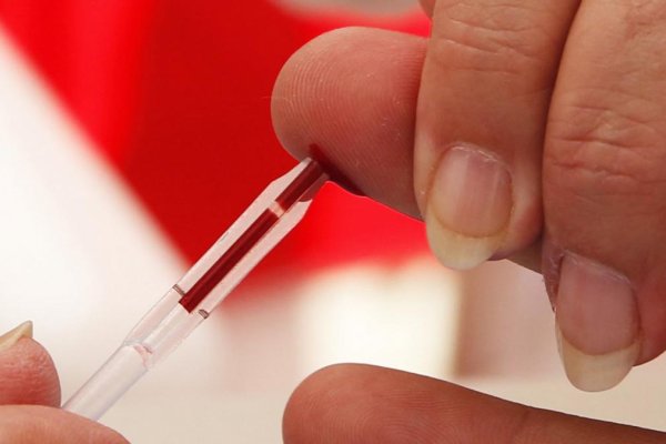 SIDA en La Rioja: Las cifras se mantienen y preocupa la cantidad de casos de sífilis