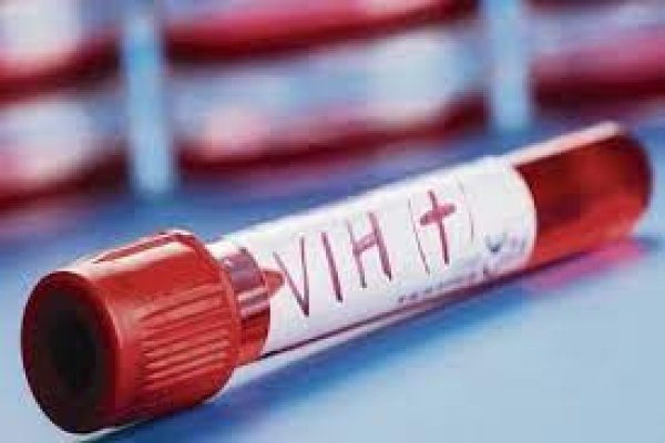 Preocupan los altos índices de contagios de VIH