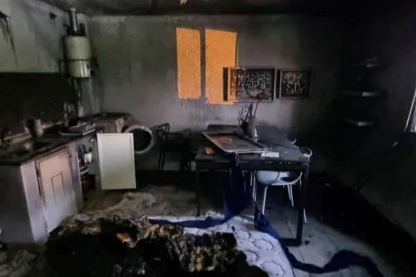 Una mujer sufrió quemaduras tras el incendio de su departamento