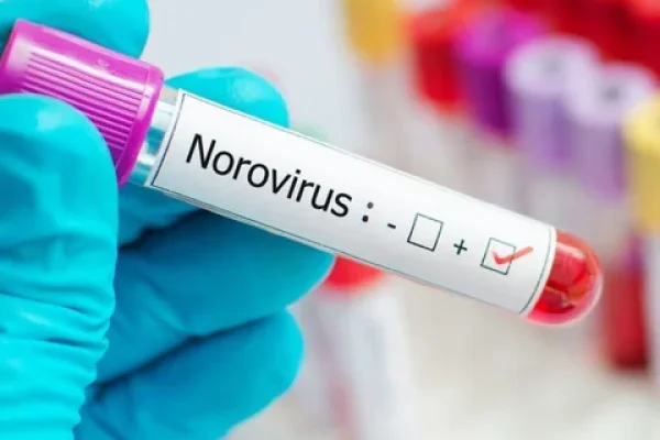 Qué es el norovirus, la enfermedad que afectó a 180 estudiantes en Bariloche
