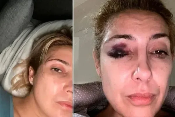 Difundieron nuevas fotos de Fabiola Yañez con golpes en su rostro