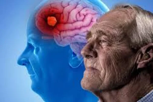 Desafíos y futuro de la enfermedad de Alzheimer