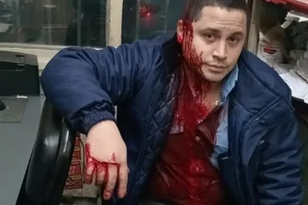 Brutal agresión a un colectivero de la 126: impactante video de cuando lo acuchillan