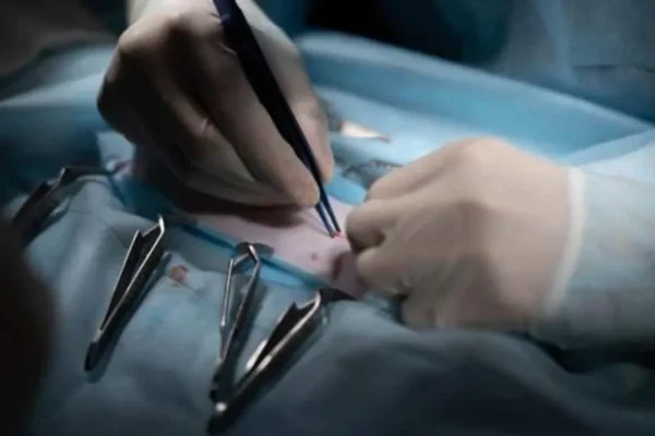 Violó a una niña y la Justicia ordenó su castración quirúrgica