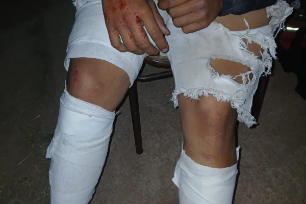 Un menor resultó herido tras caer de su moto al evadir un control policial en la Ruta 38