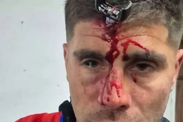 Salvaje ataque a un jugador del Ascenso: le clavaron una llave en la cabeza