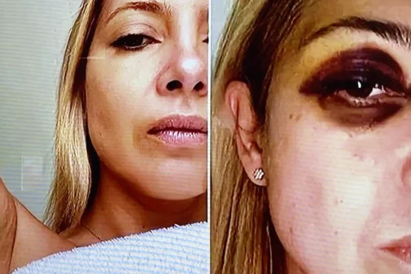 Fabiola Yañez ratificó que Alberto Fernández la golpeó: “Ese ojo morado existió”