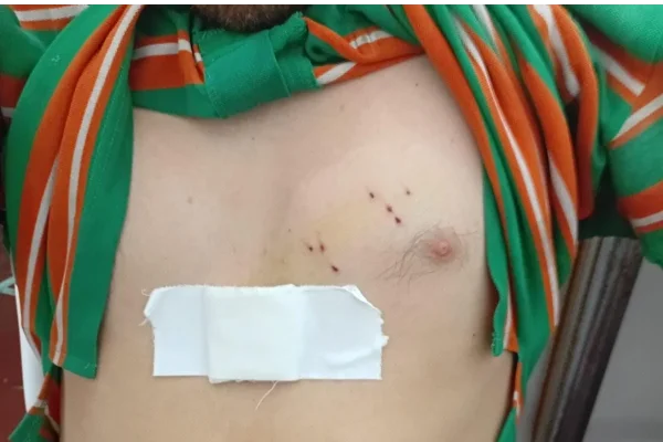 Joven fue apuñalado tras pelear con dos personas al salir de un baile