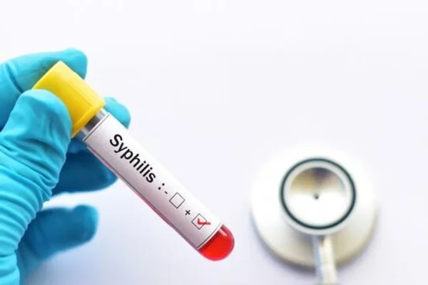 “Crisis en el sistema de salud”: especialistas advierten sobre el aumento de sífilis