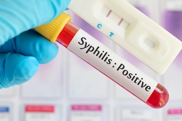 Sífilis: qué es, cómo se transmite y cuáles son las claves para prevenirla