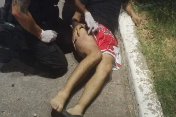 Hizo un willie en moto y terminó con una fractura