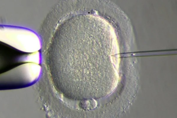 Un donante de esperma con un gen cancerígeno engendró casi 200 bebés en Europa: algunos ya murieron