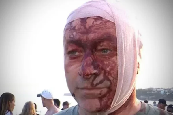 Sobrevivió al ataque terrorista de Hamas del 7 de octubre y años después resultó herido en el atentado en Australia: “Fue una masacre”