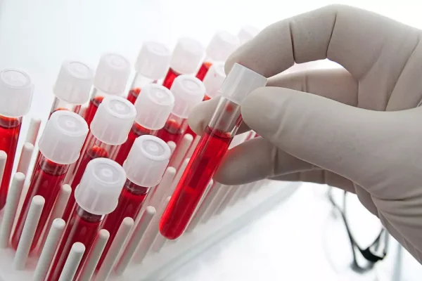 Crecen las infecciones de transmisión sexual y piden emergencia sanitaria en La Rioja
