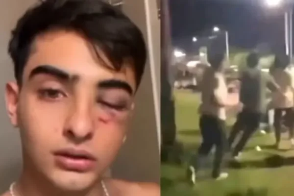 Prisión preventiva para los dos detenidos por la brutal golpiza a un joven en Tucumán