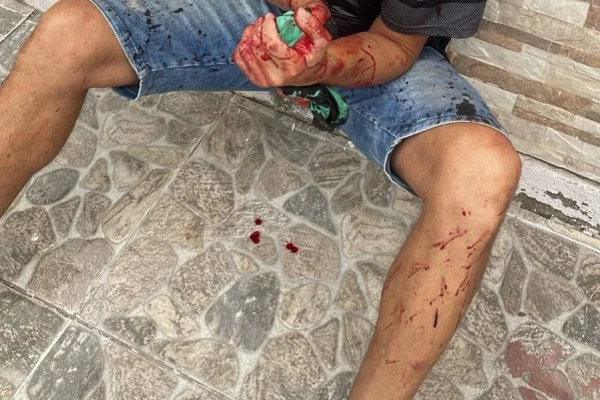 Joven fue atacado a machetazos en una vivienda del macrocentro