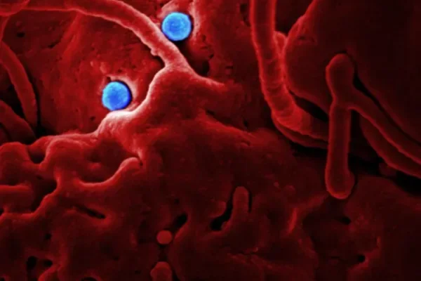 Alerta por ébola en Argentina: detectan embarcaciones provenientes de zonas de riesgo