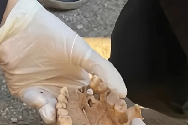 Sigue la investigación por los restos óseos hallados en el Club Náutico