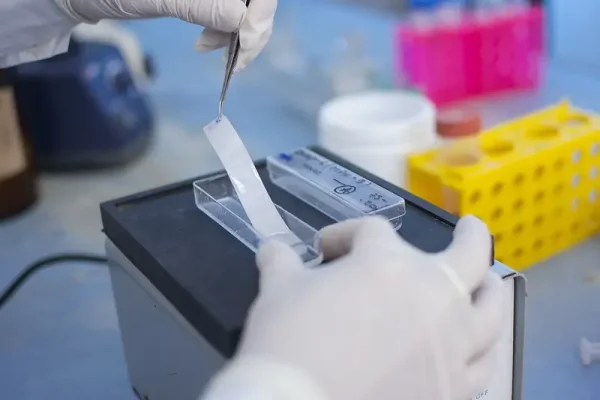 Científicos riojanos dan un paso clave en la regeneración de nervios dañados